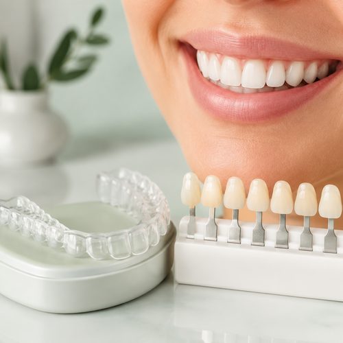 Smile next to a tooth shade guide and clear aligner tray